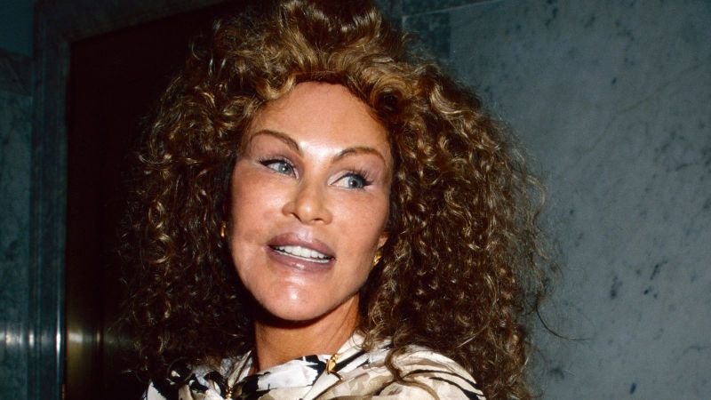 Muere Jocelyn Wildenstein, conocida como la “mujer gato” por sus cirugías estéticas extremas