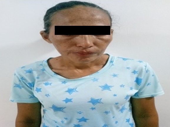Adolescente se tomó un blister de pastillas por los malos tratos de su madre